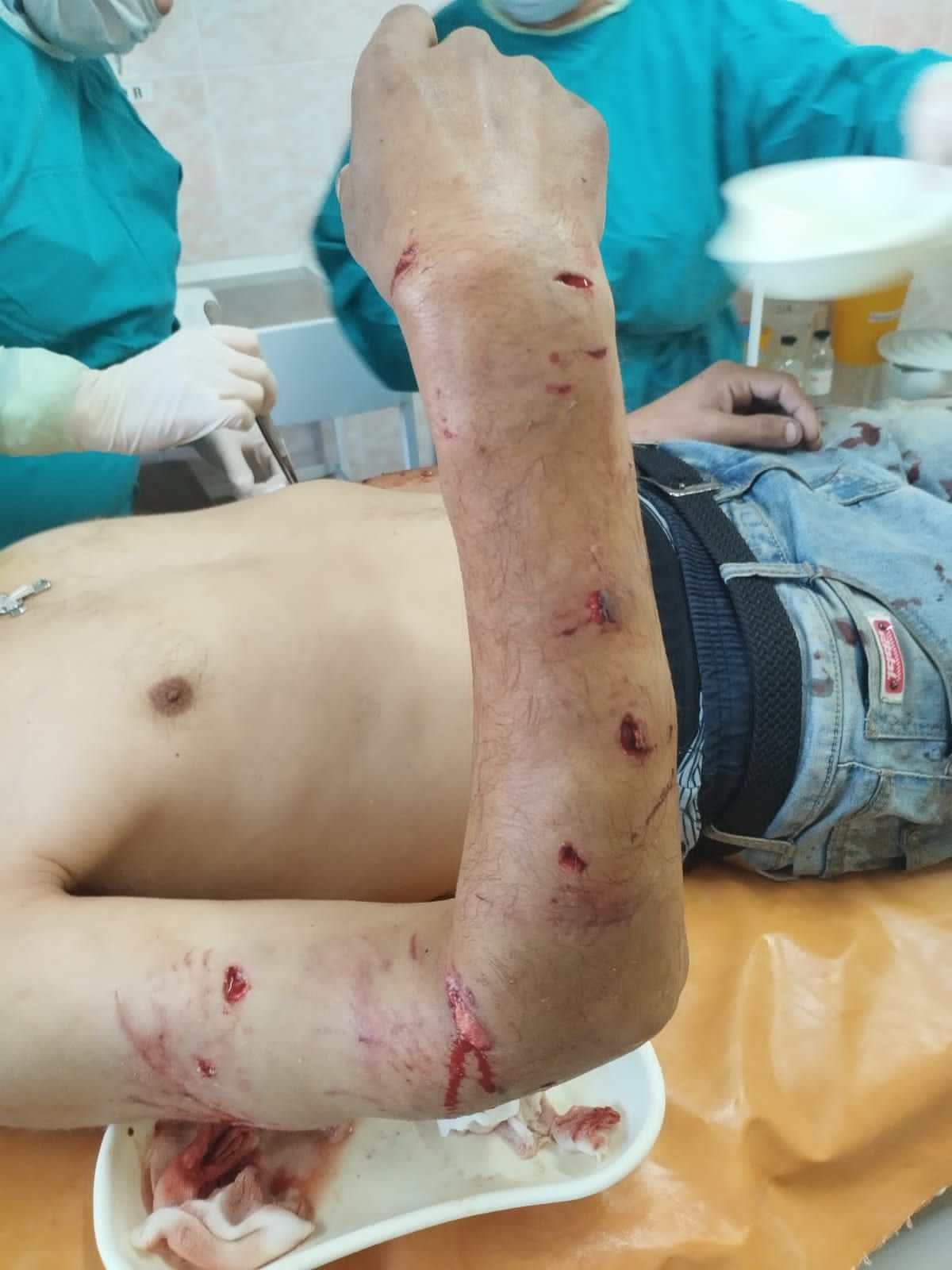 Нурлатец поступил в больницу с рваными ранами от укуса собак