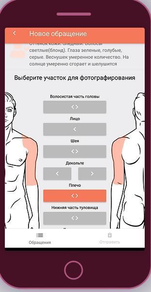 В приложении «ПроРодинки» татарстанцы могут проверить свои родинки и пигментные пятна